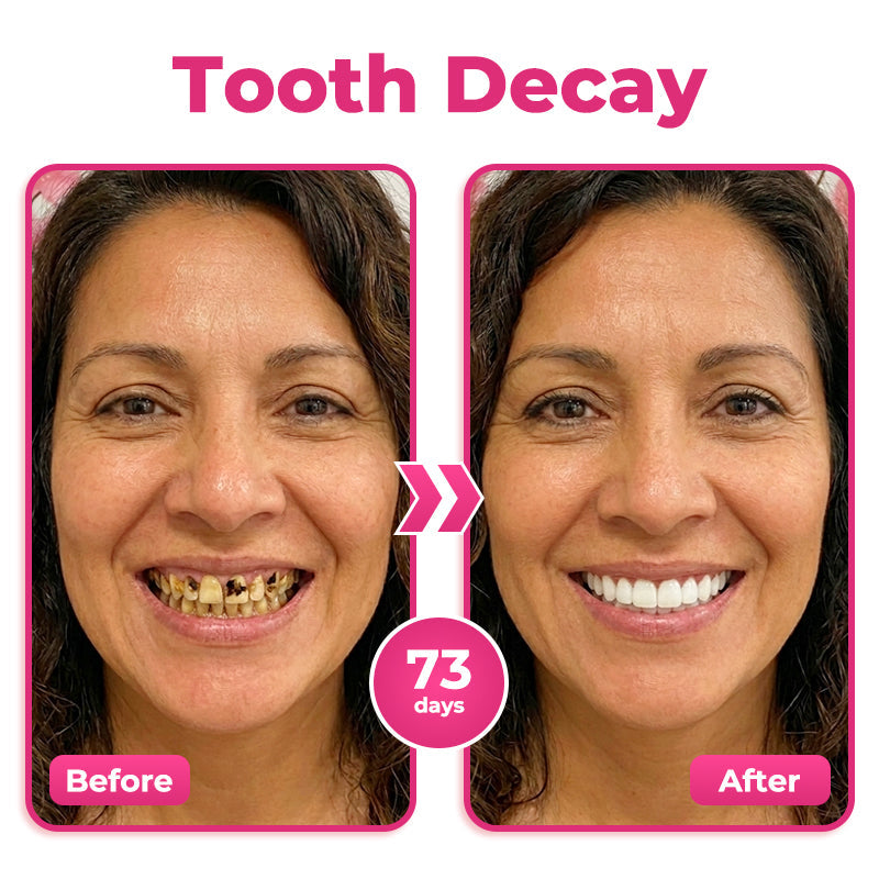 🔥 Buy 1, Get Your Second Item 50% OFF — Today Only!🦷  Natravor® Thismile NH-10 Toothpaste Serum for Enamel & Gum Care – Advanced Therapypy