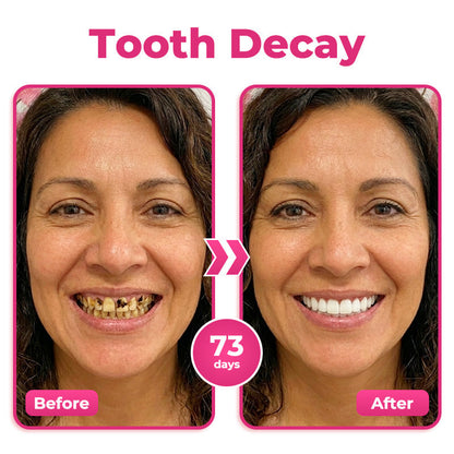 🔥 Buy 1, Get Your Second Item 50% OFF — Today Only!🦷  Natravor® Thismile NH-10 Toothpaste Serum for Enamel & Gum Care – Advanced Therapypy
