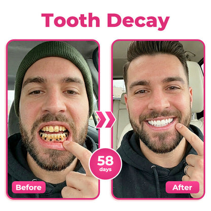 🔥 Buy 1, Get Your Second Item 50% OFF — Today Only!🦷  Natravor® Thismile NH-10 Toothpaste Serum for Enamel & Gum Care – Advanced Therapypy
