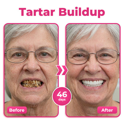 🔥 Buy 1, Get Your Second Item 50% OFF — Today Only!🦷  Natravor® Thismile NH-10 Toothpaste Serum for Enamel & Gum Care – Advanced Therapypy