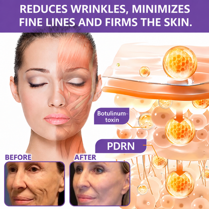 Natravor®🎗️ PDRN Multi-Peptide Massage Roller Cream – Anti-Aging, Hydrating, Firming & Lifting Care for Smoother, More Radiant-Looking Skin