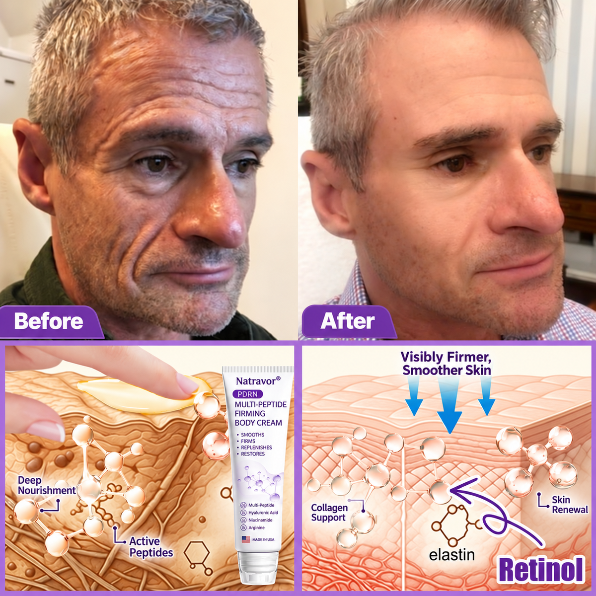 Natravor®🎗️ PDRN Multi-Peptide Massage Roller Cream – Anti-Aging, Hydrating, Firming & Lifting Care for Smoother, More Radiant-Looking Skin
