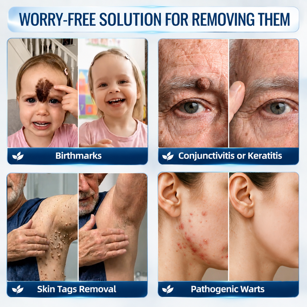 Natravor® 7-𝐃𝐚𝐲 𝐒𝐤𝐢𝐧 𝐓𝐚𝐠 & 𝐒𝐩𝐨𝐭 𝐄𝐫𝐚𝐬𝐞𝐫 𝐂𝐫𝐞𝐚𝐦 (Zero Pain, Zero 𝐒𝐜𝐚𝐫𝐬 Formula) 💎